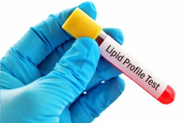 Lipid Profile